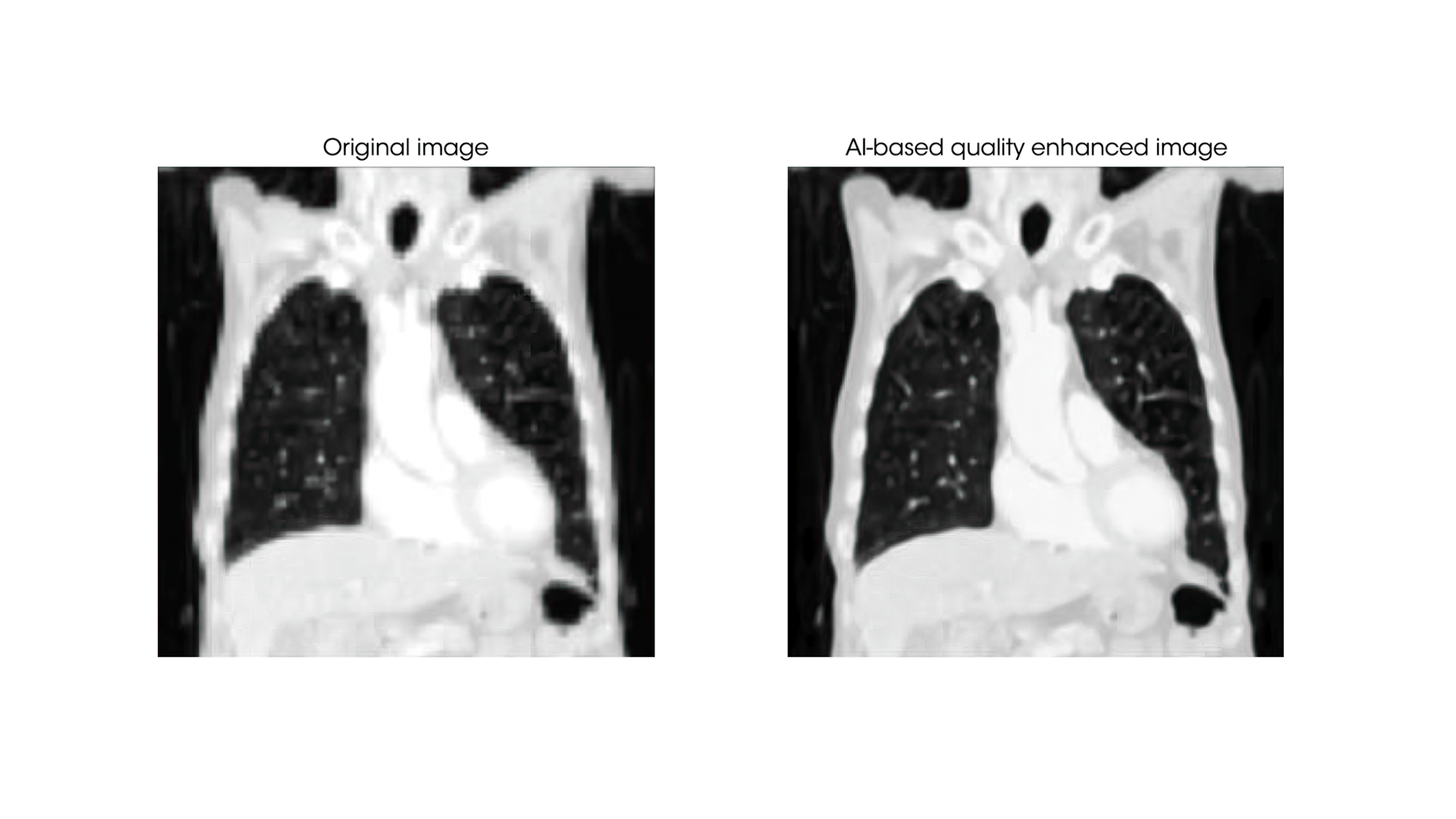 Benefits of AI in radiology
