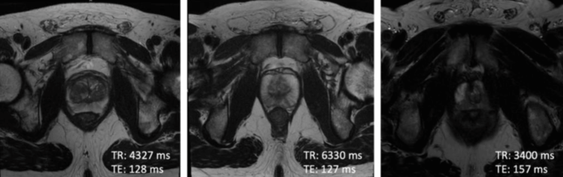 MRI image harmonization