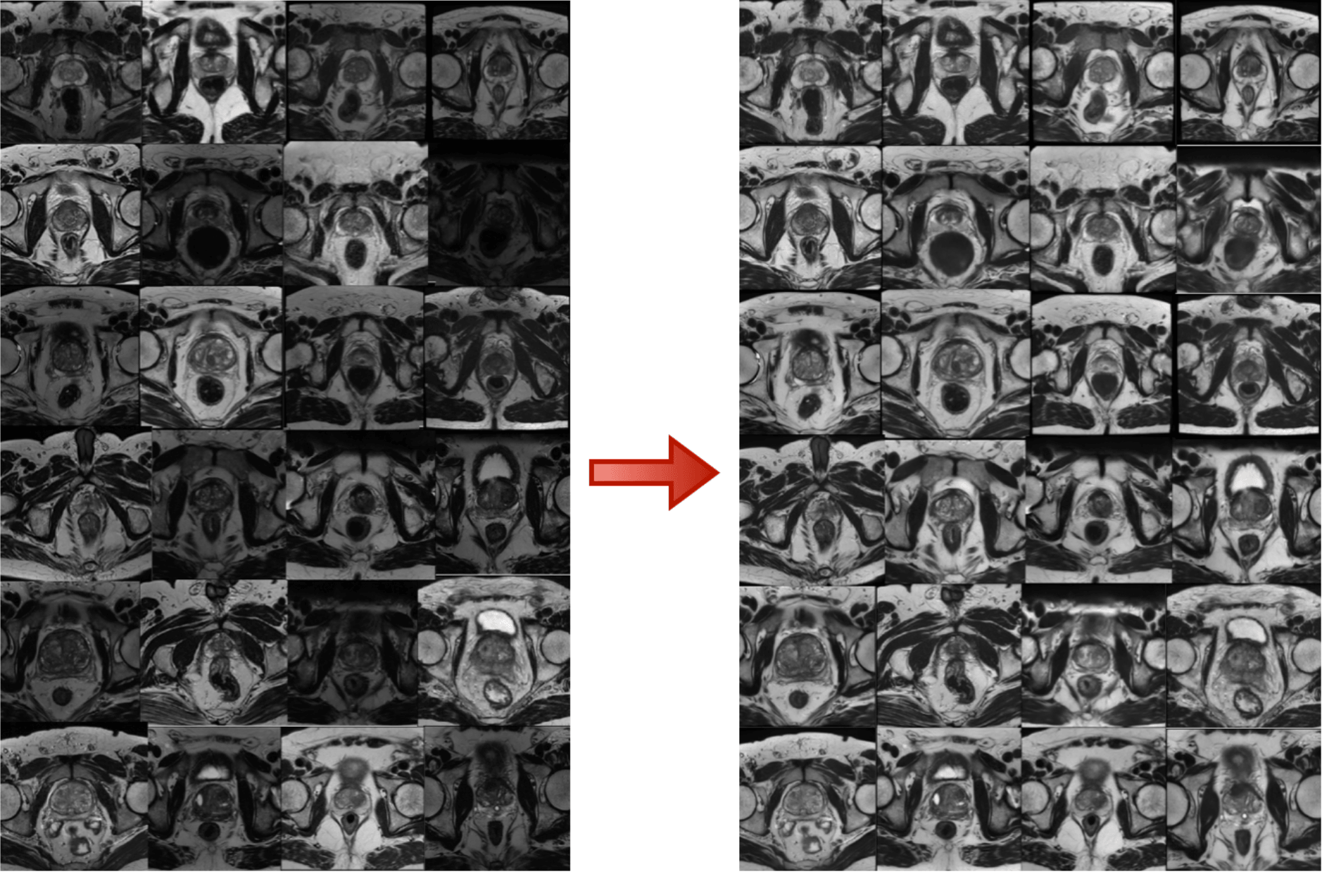 MRI image harmonization