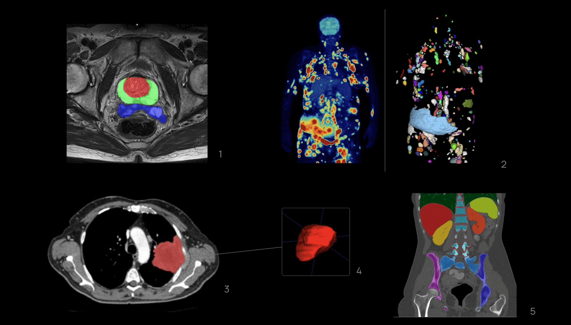 medical ai segmentation