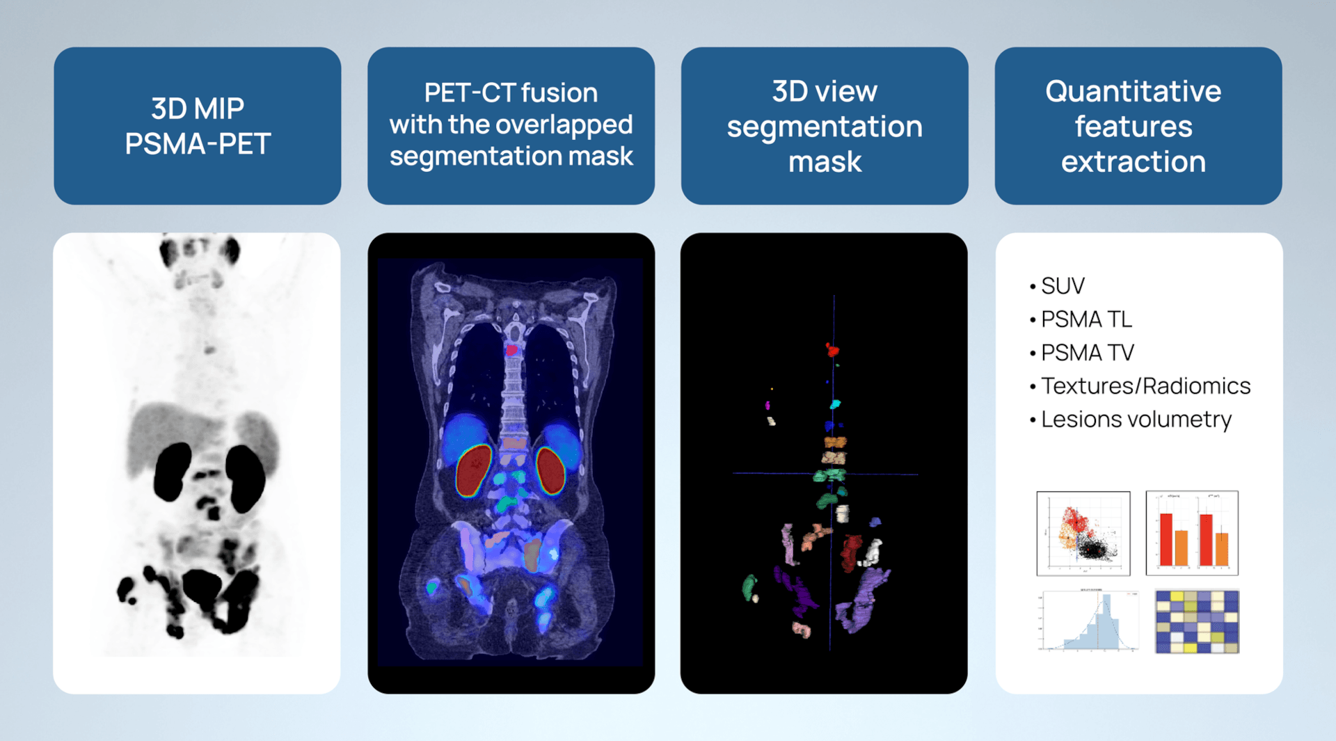 Prostate Cancer Clinical Trials
