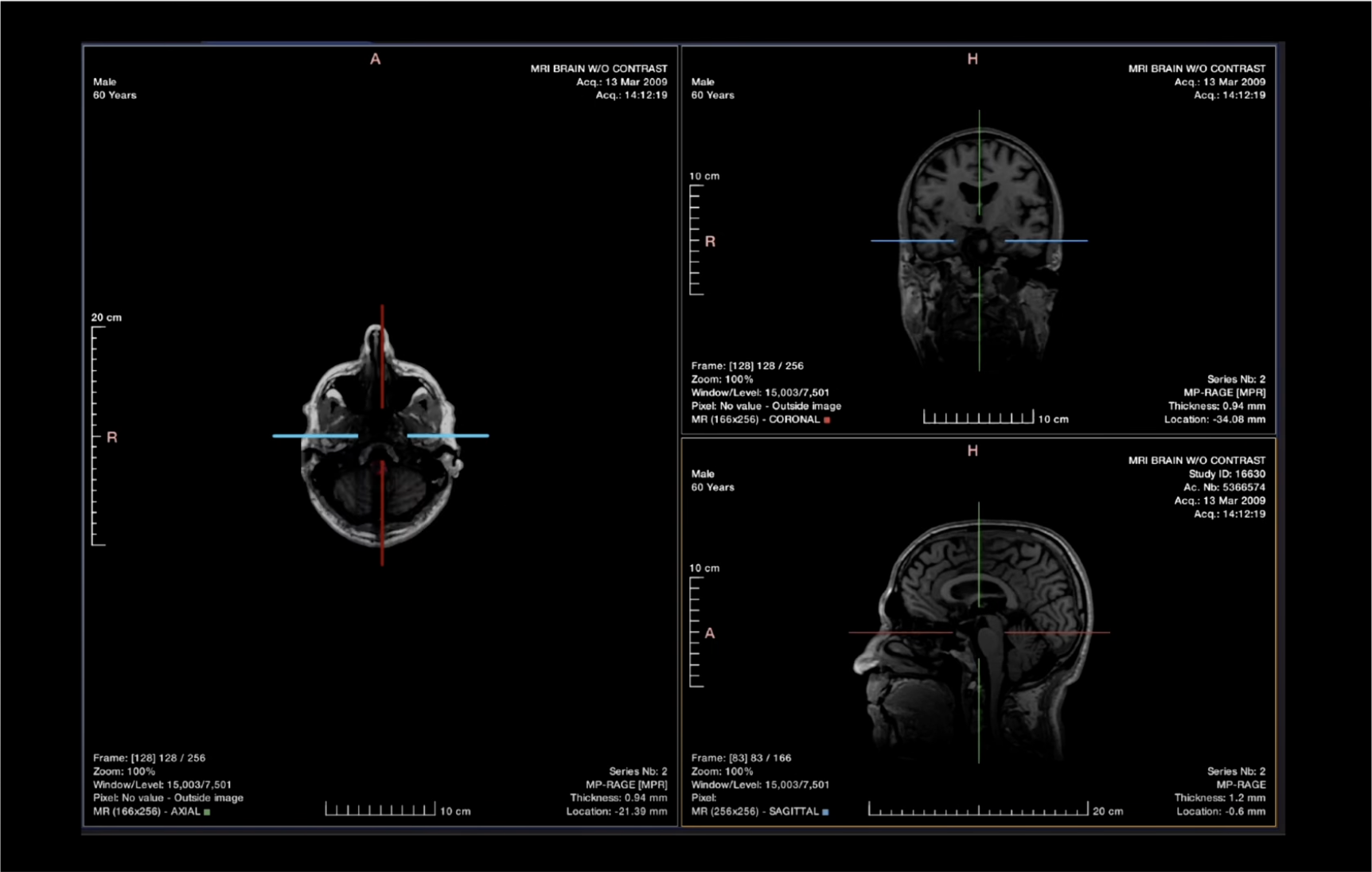 AI diagnostic imaging 