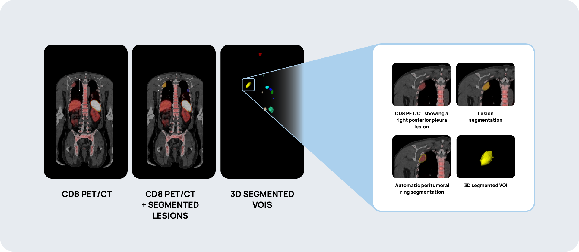 241205_Inmune PET_Diagram