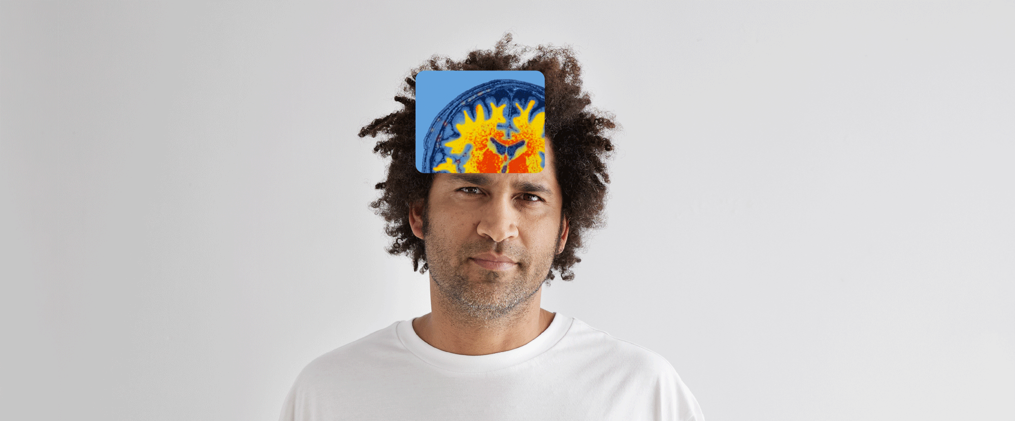 quibim_hero_brain2_2024