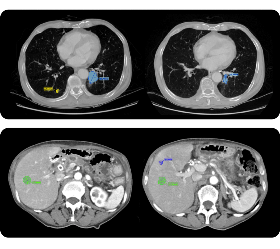 AI-supported-lesion-assessment-tool