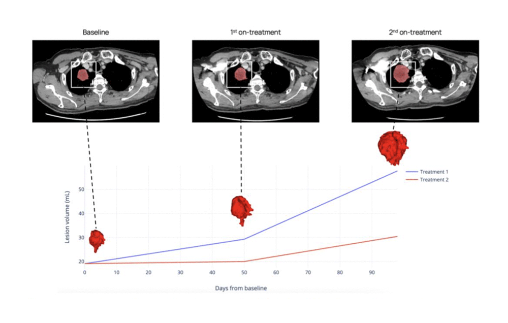 Tumor-growth-kinetics