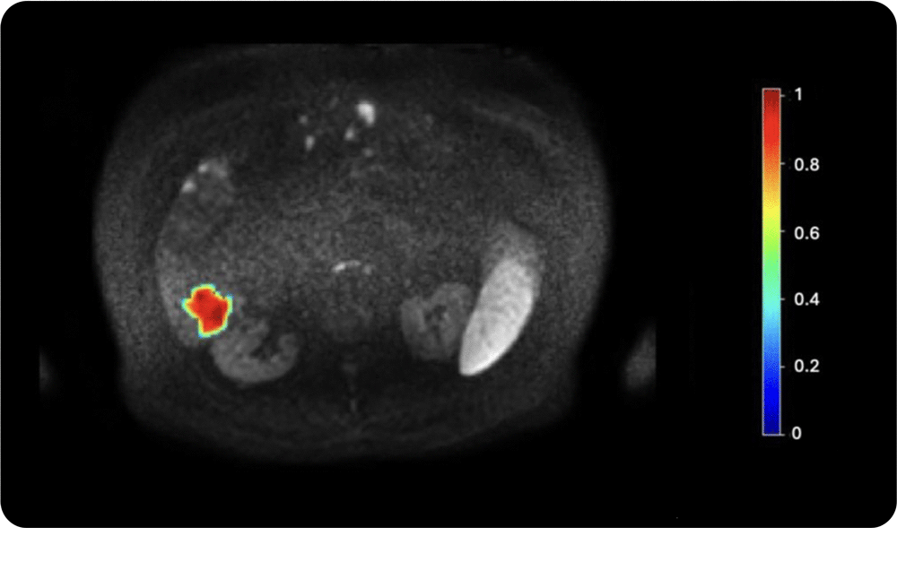 Tumor-heterogeneity-assessment