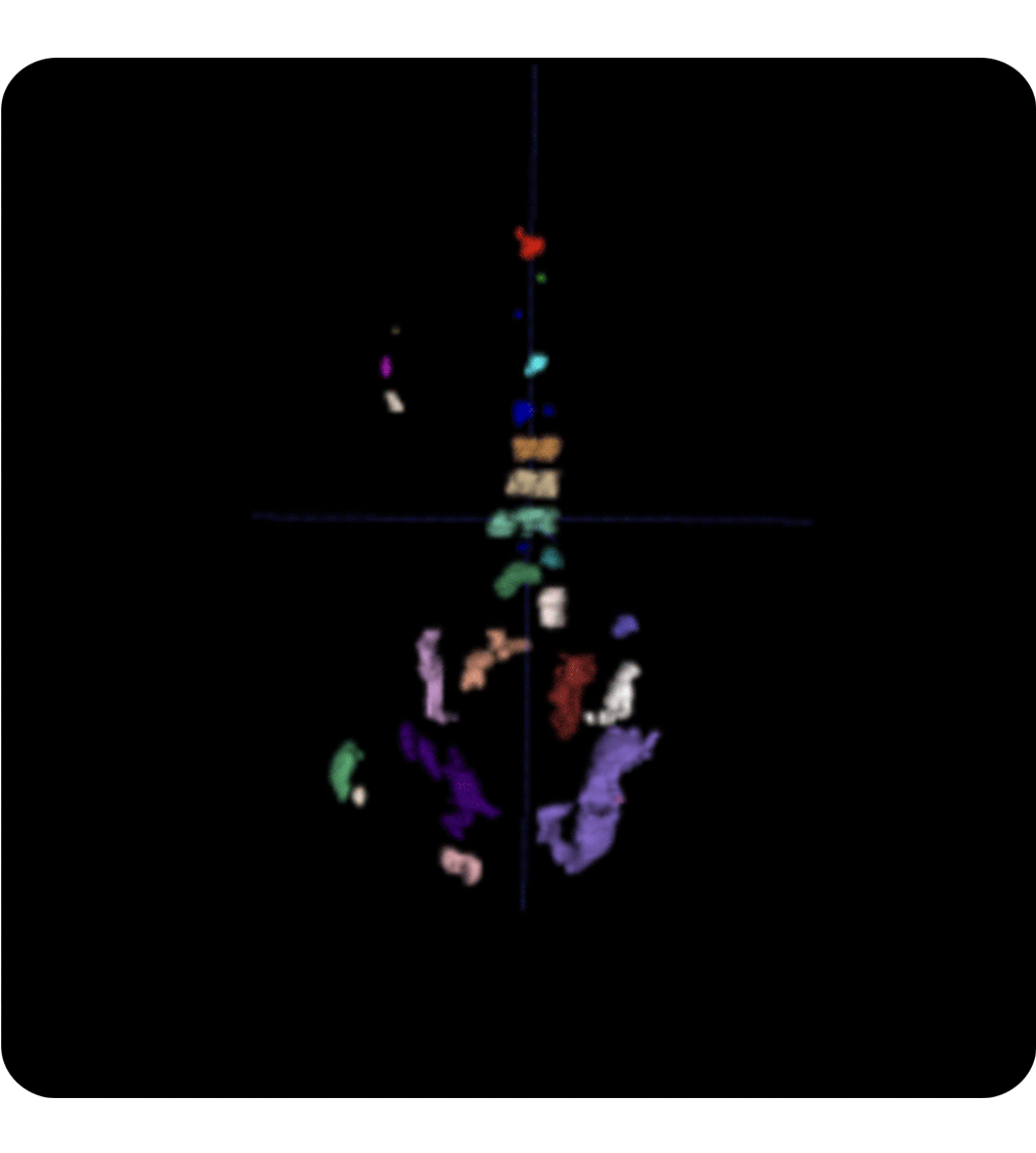 Whole-body-tumor-burden-assessment