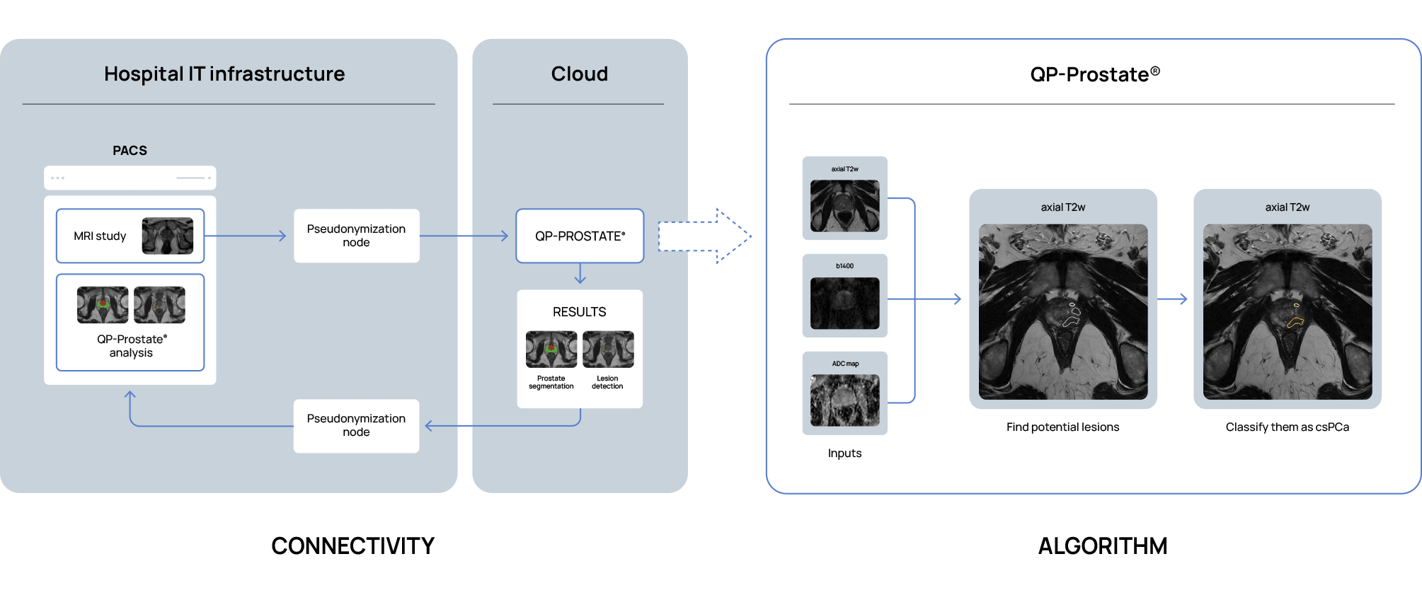 quibim-diagram-prostate-1