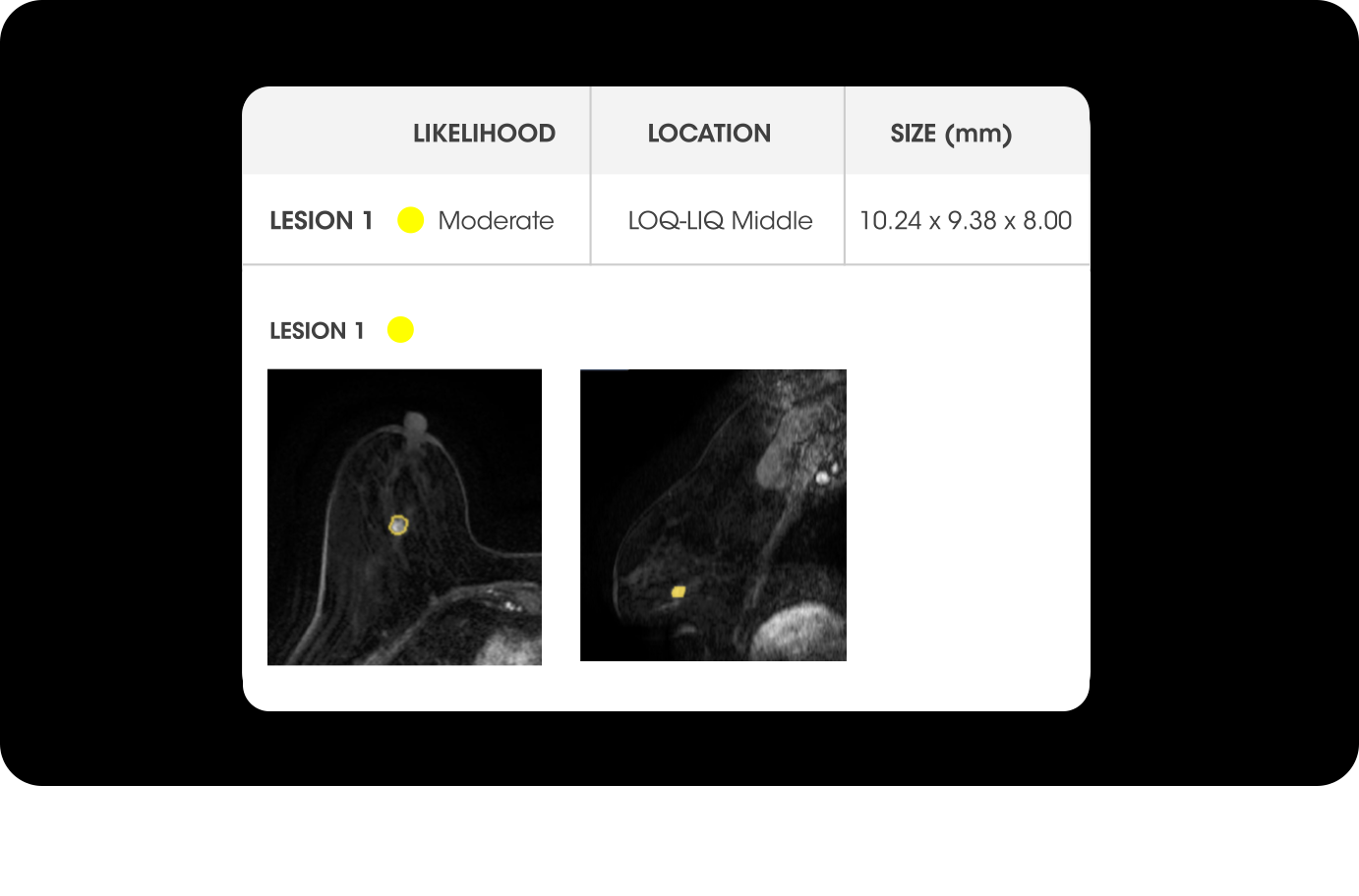 QP-Breast_Web_02_v4